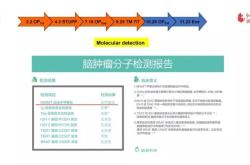 胶质瘤靶向治疗的影响因素挑战与机遇