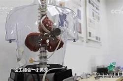 国产人工心脏新纪元火箭心实验羊三年存活创纪录