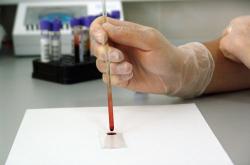 科学家引导HIV叛变，共同对抗艾滋病毒——一种革命性的治疗策略